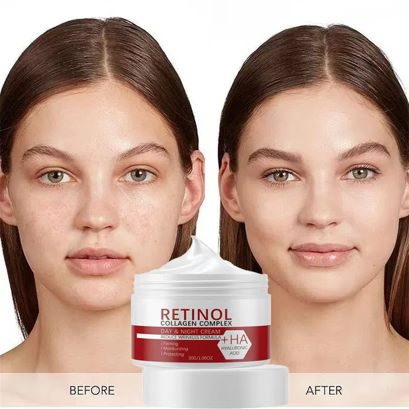 Face Body Whitening Cream Retinol Collagen Hyaluronic Acid 3In1 Remove Dark Spots Eliminate Melanin Dispel Acne Lighten the Skin