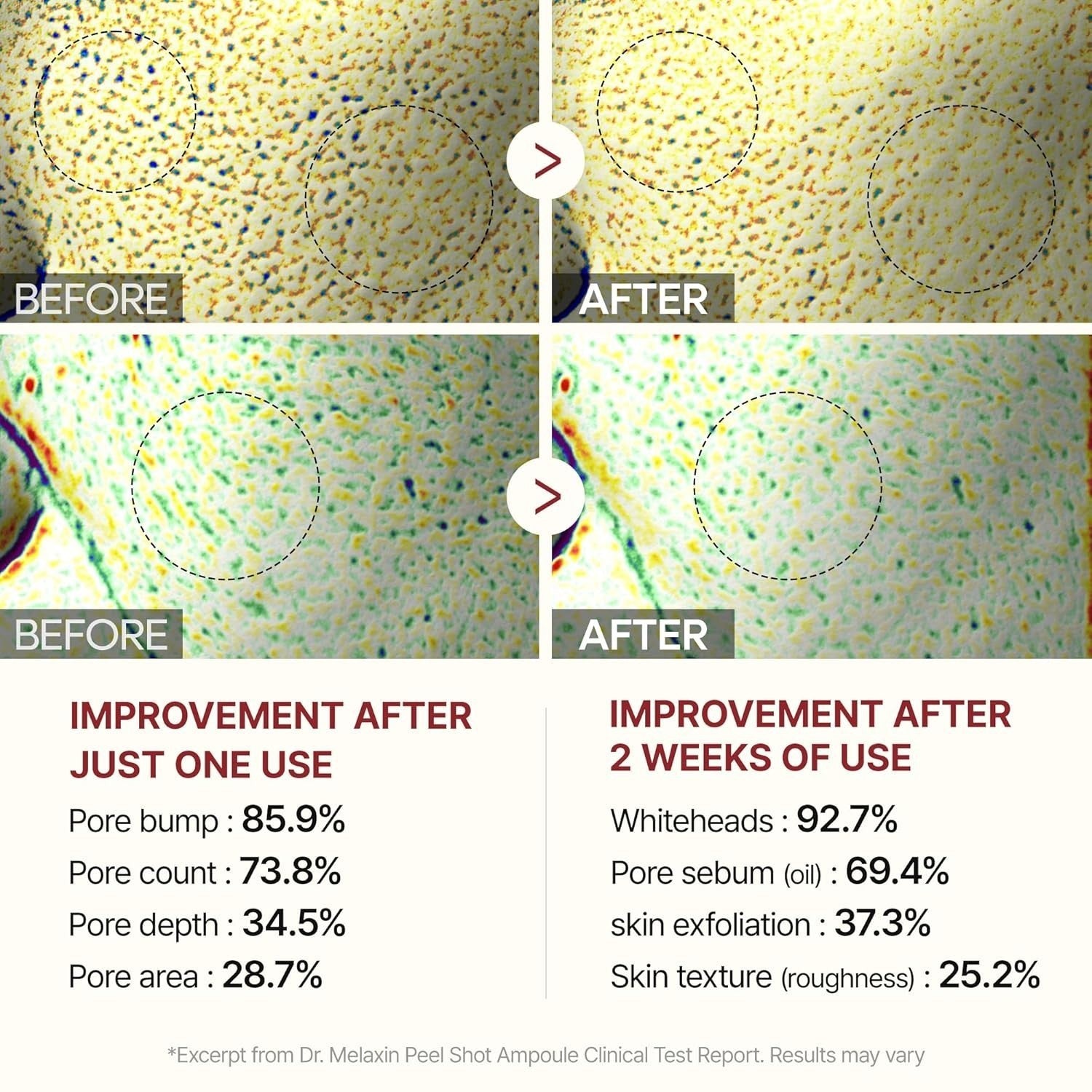 Duo-Dr.Melaxin PEEL SHOT GLOW EXFOLIANT RICE AMPOULE 80Ml (WHITE / BLACK RICE)