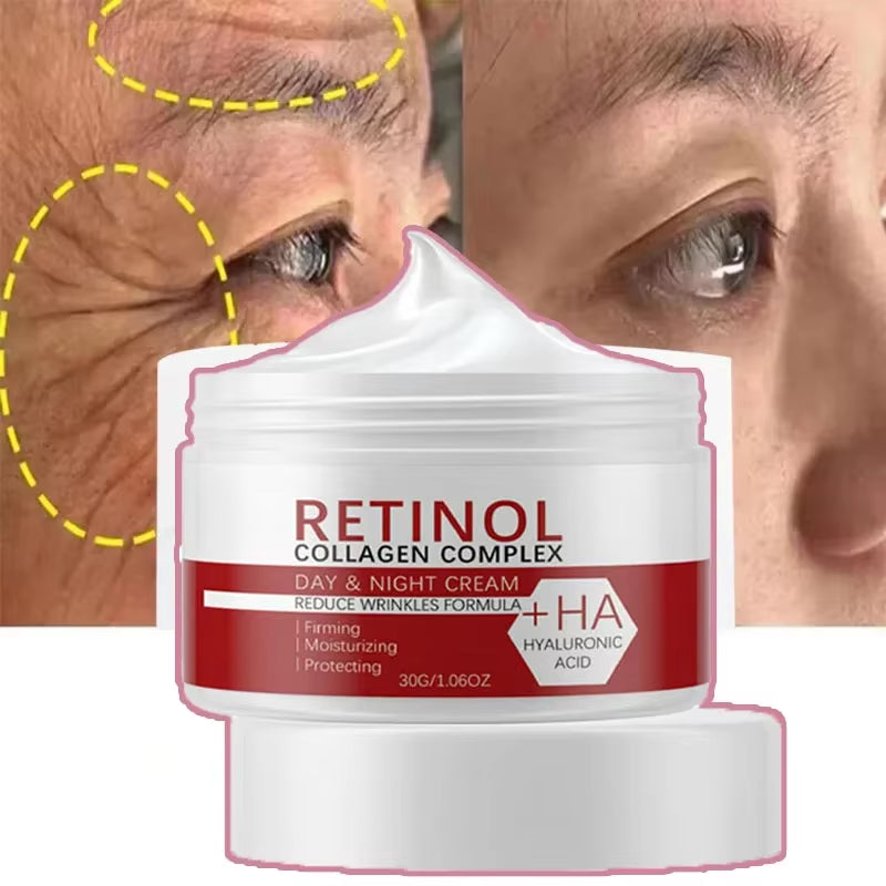 Face Body Whitening Cream Retinol Collagen Hyaluronic Acid 3In1 Remove Dark Spots Eliminate Melanin Dispel Acne Lighten the Skin