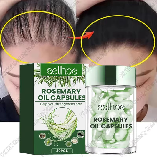 Revitalize Your Hair with Rosemary Essential Oil - Fast Hair Growth Serum for Men and Women, Combat Hair Loss and Restore Shine!