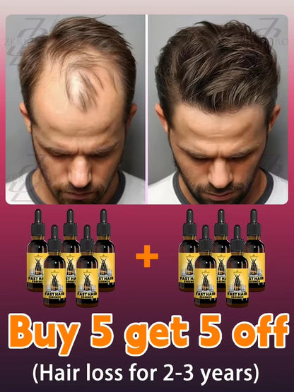 2025 Hair Growth Oil, Repair Baldness, Hairline, Rapid Hair Growth Hair Growth Oil for Men