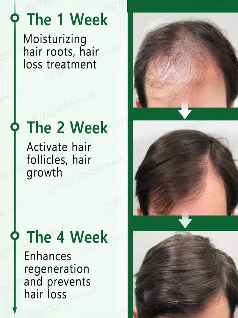 2025 Hair Growth Oil, Repair Baldness, Hairline, Rapid Hair Growth Hair Growth Oil for Men