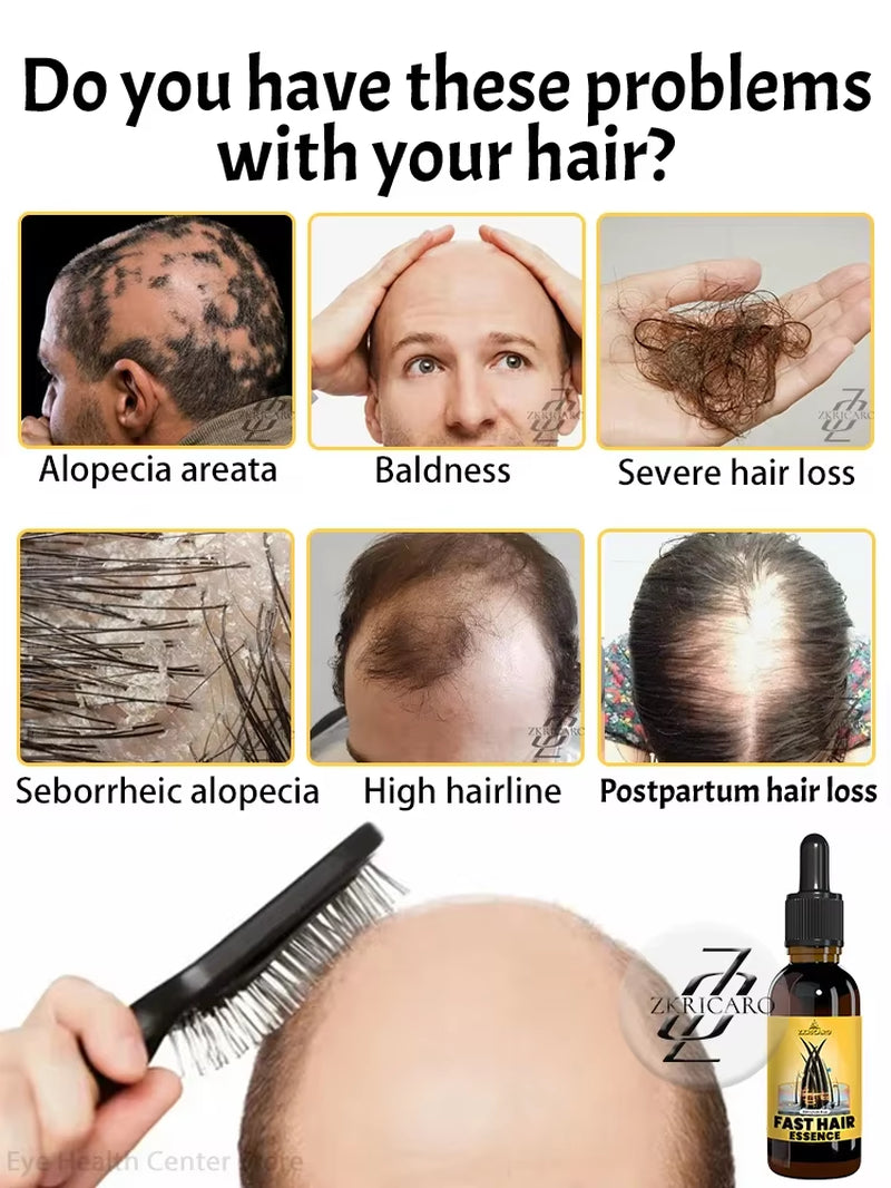 2025 Hair Growth Oil, Repair Baldness, Hairline, Rapid Hair Growth Hair Growth Oil for Men