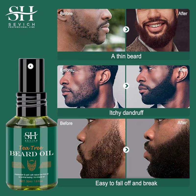 SEVICH Growth Beard Oil for Men Moisturizing Styling Trim Care Thicker Promote Beard Regrowth Strengthen Shine Soften Beard Oil