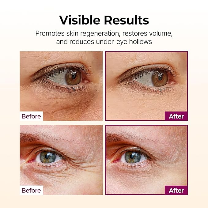 Eye Cream Stick | Brighten Dark Circles & Smooth Fine Lines