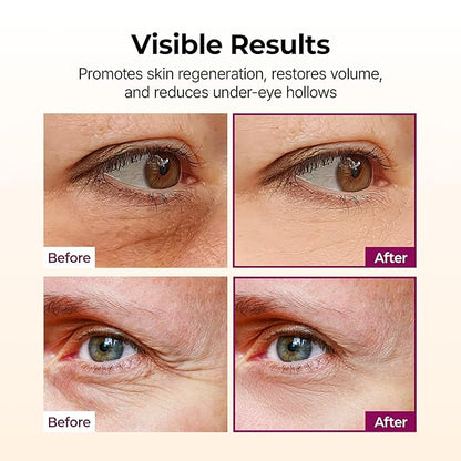Eye Cream Stick | Brighten Dark Circles & Smooth Fine Lines