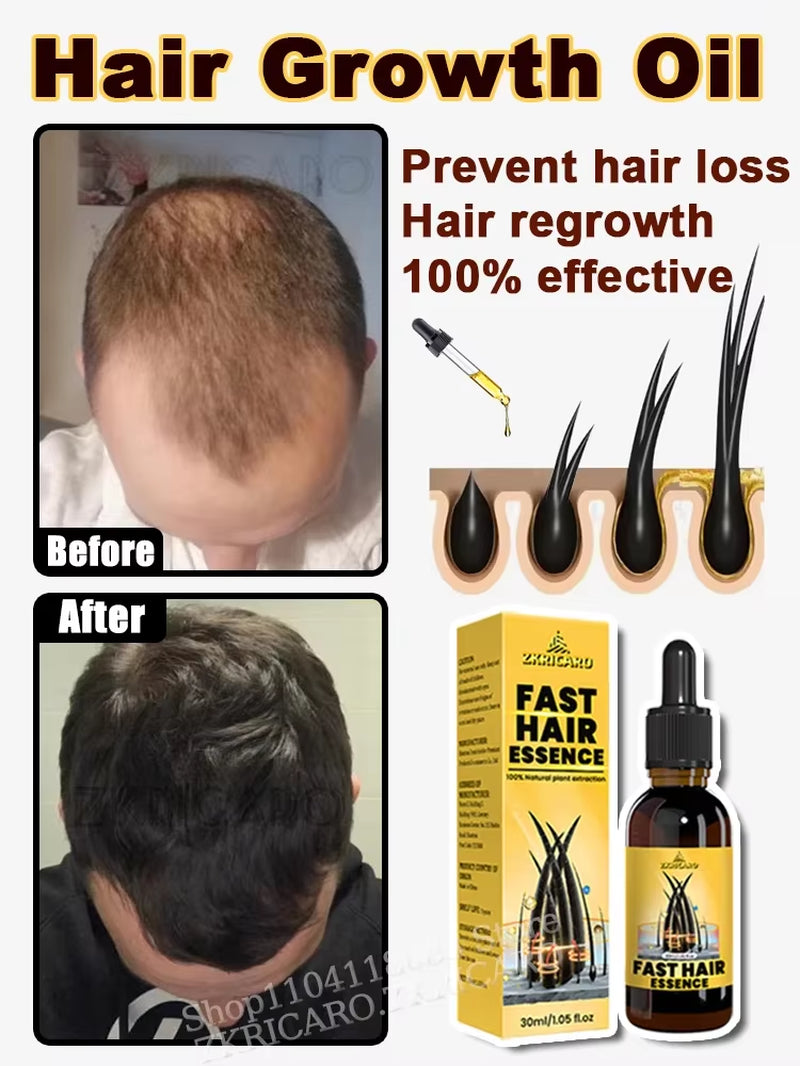 2025 Hair Growth Oil, Repair Baldness, Hairline, Rapid Hair Growth Hair Growth Oil for Men