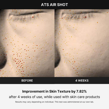 Age-R ATS Air Shot - Microneedling Pore Tightening Skin Care Device for Enhanced Absorption, Pore Refinement, and Smoother Skin Texture - Exfoliation, Skin Rejuvenation - Korean Skin Care
