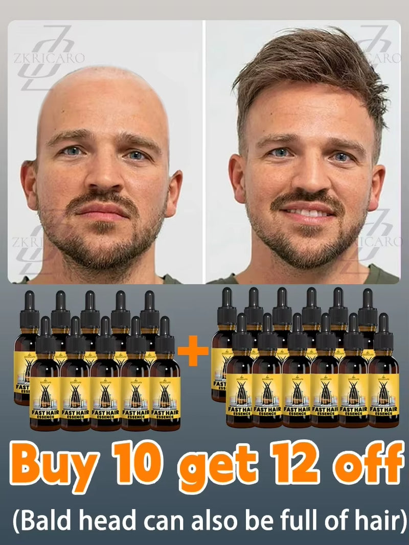 2025 Hair Growth Oil, Repair Baldness, Hairline, Rapid Hair Growth Hair Growth Oil for Men