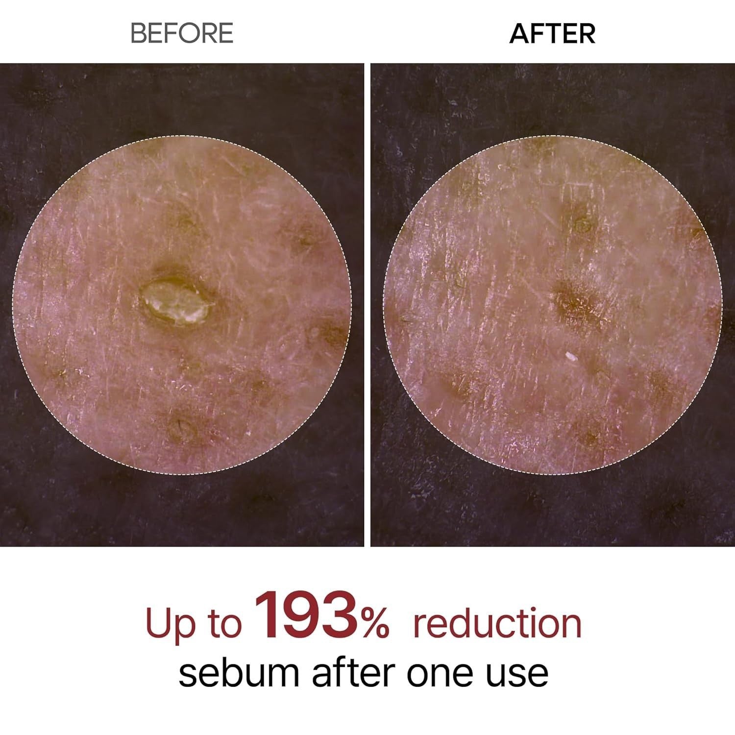 Duo-Dr.Melaxin PEEL SHOT GLOW EXFOLIANT RICE AMPOULE 80Ml (WHITE / BLACK RICE)