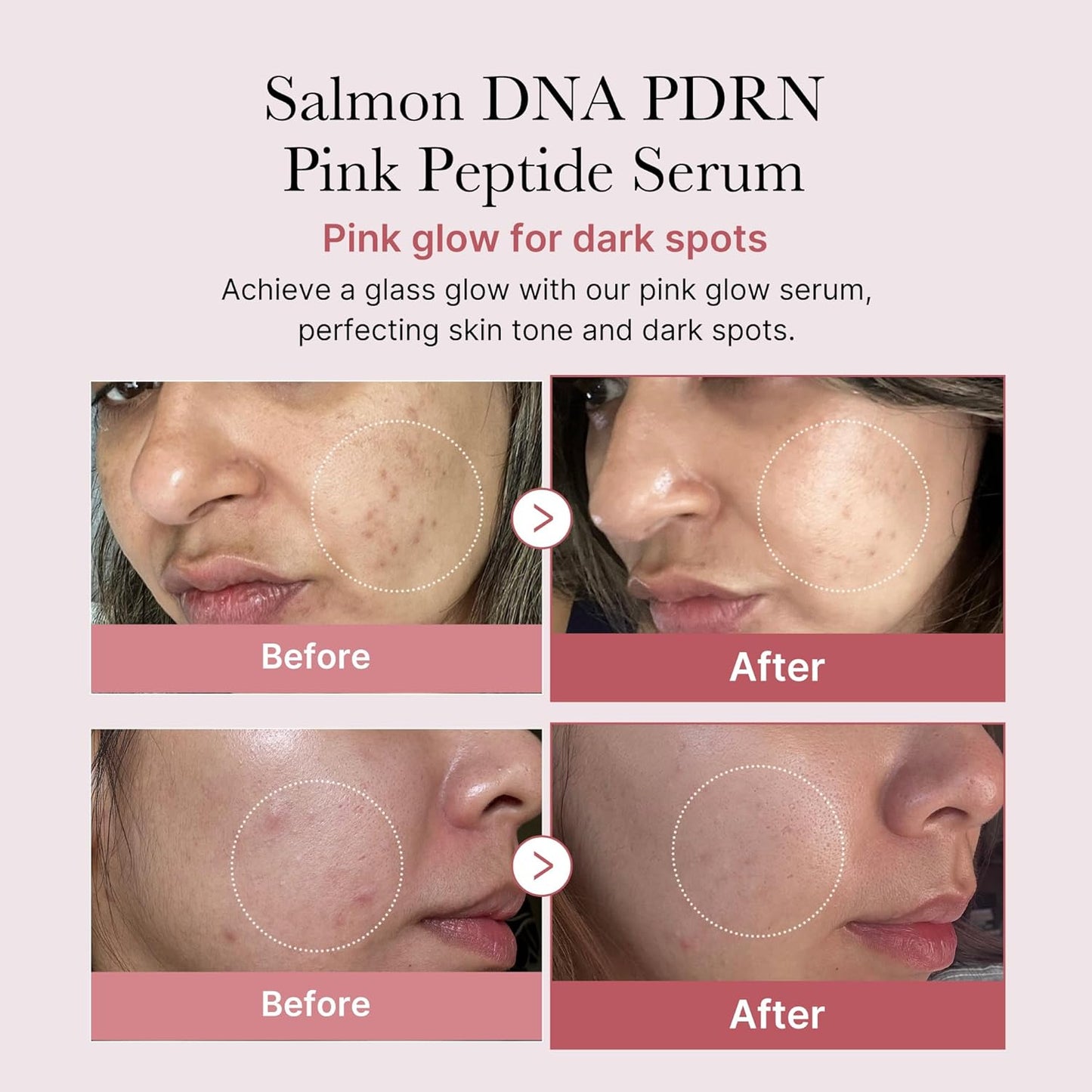 Salmon DNA PDRN Pink Peptide Serum, Pink Glow Serum, Peptide, Niacinamide, Hydrating & Moisturizing & Firming, Uneven Skin Tone, Korean Skincare | 1.01 Fl.Oz. (1.01 Fl.Oz., Salmon DNA PDRN)
