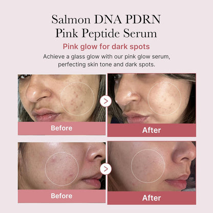 Salmon DNA PDRN Pink Peptide Serum, Pink Glow Serum, Peptide, Niacinamide, Hydrating & Moisturizing & Firming, Uneven Skin Tone, Korean Skincare | 1.01 Fl.Oz. (1.01 Fl.Oz., Salmon DNA PDRN)