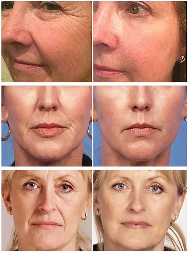 Wrinkle Remove Dragon Blood Cream Whitening Moisturizing Repair Cosmetics Anti-Aging Women Face Beauty Nourish Skin Care Product